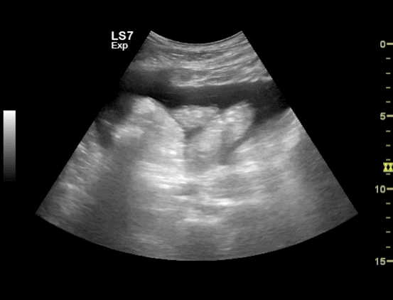 EEU case image missing